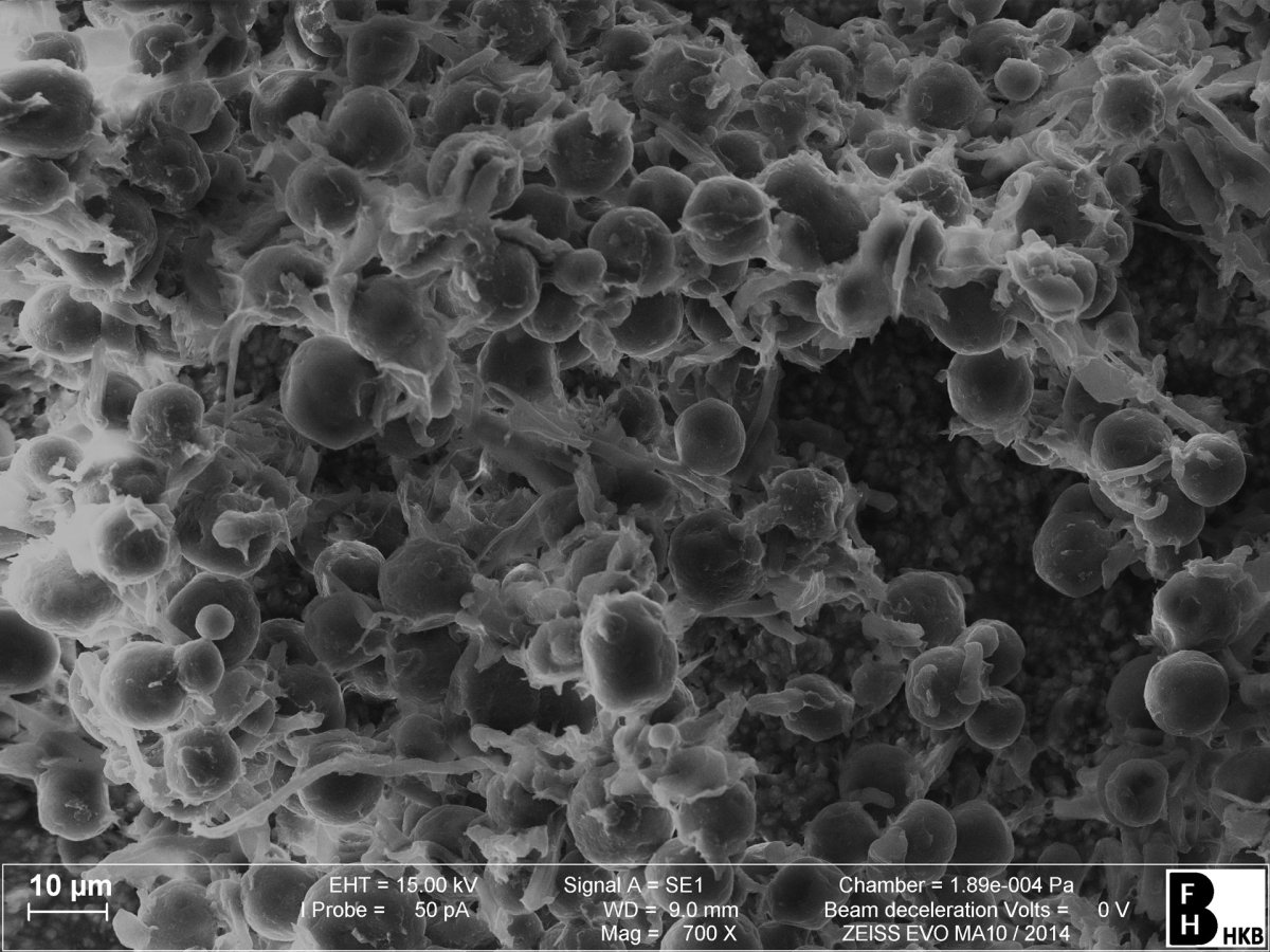 Hinterfüllmaterial im Rasterelektronenmikroskop (REM)